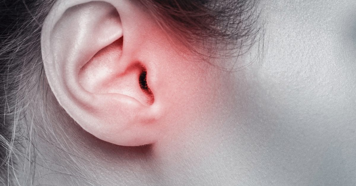 EFFECTIVE TREATMENT OF EXPERIMENTAL ACUTE OTITIS MEDIA BY APPLICATION OF VOLATILE FLUIDS INTO THE EAR CANAL